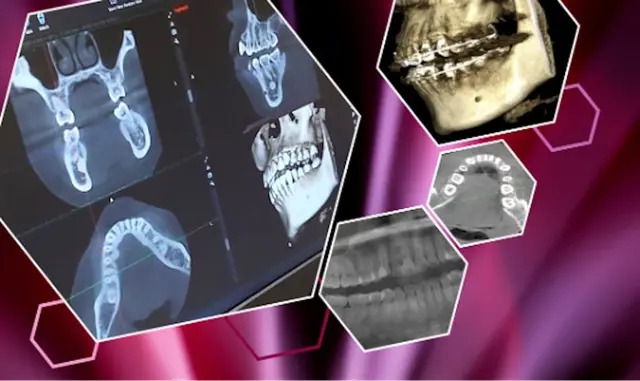 Anatomy and Pathology in Dento-MaxilloFacial Radiology (DMFR) - The Art & Science of Good Reporting